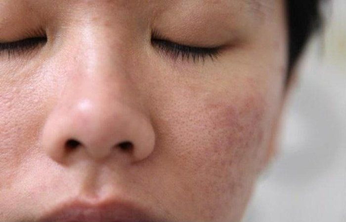 Retinoids là gì? Nguyên lý hoạt động và phân loại