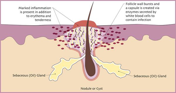 Retinoids là gì? Nguyên lý hoạt động và phân loại