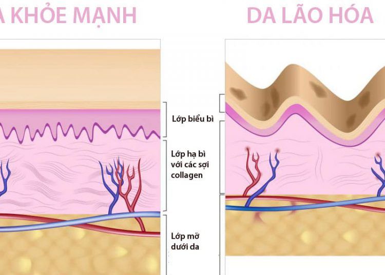 Kiểm tra độ đàn hồi của da và cách duy trì