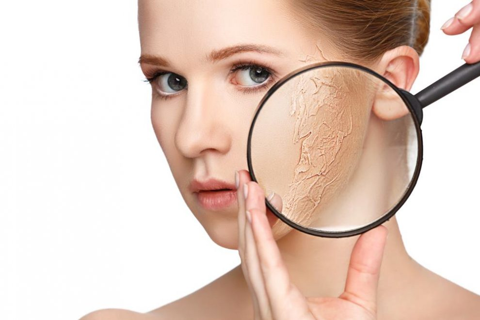 Làn da khô nếu không được chăm sóc cẩn thận sẽ dễ bị lão hóa