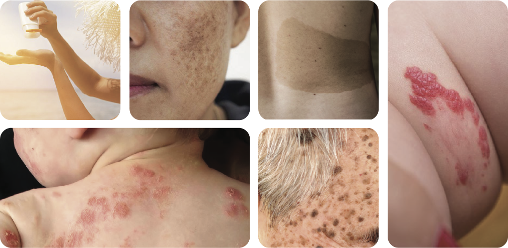 Các vấn đề về da