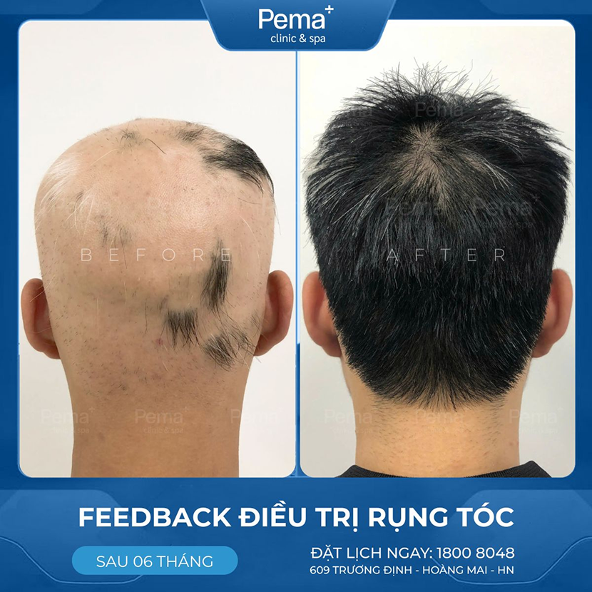 Kết quả điều trị