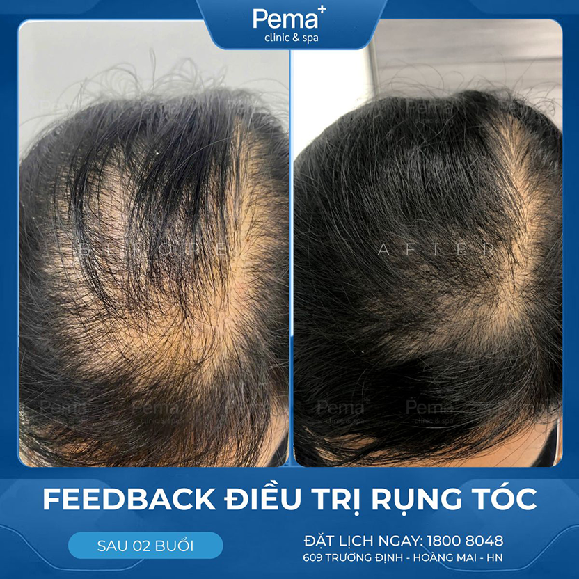 Kết quả điều trị