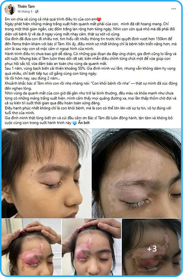 Cộng đồng bạch biến