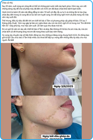 Cộng đồng bạch biến