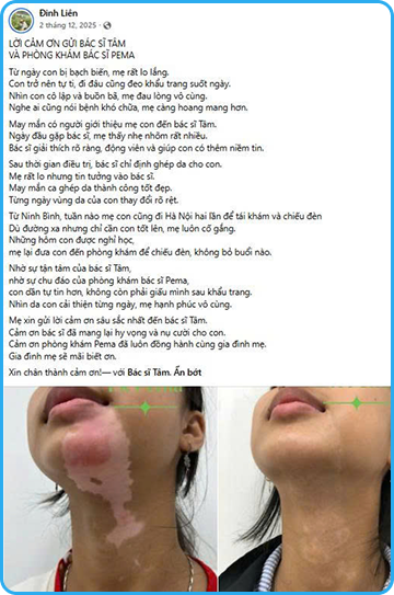 Cộng đồng bạch biến